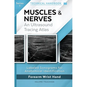 Muscles & Nerves - Technical Ultrasound Handbook: An Ultrasound Tracing Atlas (Series 1) - Paperback