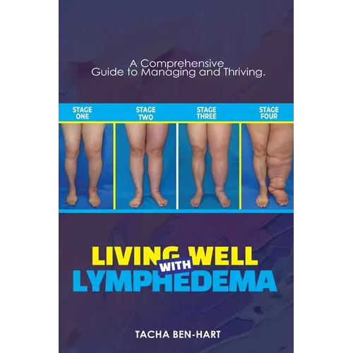 Living Well with Lymphedema: A Comprehensive Guide to Managing and Thriving - Paperback