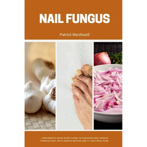 Nail Fungus: A Beginner's Quick Start Guide to Managing Nail Fungus Through Diet, With Sample Recipes and a 7-Day Meal Plan - Paperback