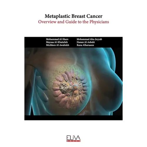 Metaplastic Breast Cancer: Overview and guide to the physicians - Paperback