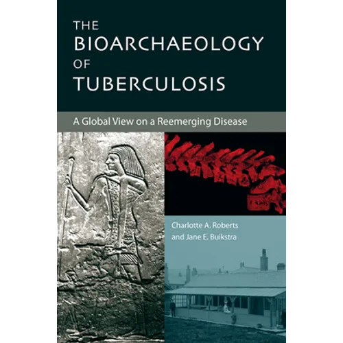 The Bioarchaeology of Tuberculosis: A Global View on a Reemerging Disease - Paperback