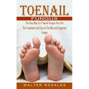 Toenail Fungus: The Easy Way to a Toenail Fungus-free Life (The Treatment and Cure of Toe Nail and Fingernail Fungus) - Paperback