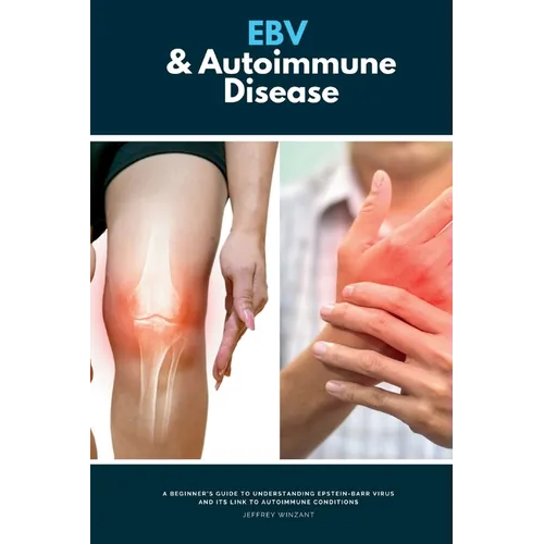 EBV & Autoimmune Disease: A Beginner's Guide to Understanding Epstein-Barr Virus and Its Link to Autoimmune Conditions - Paperback