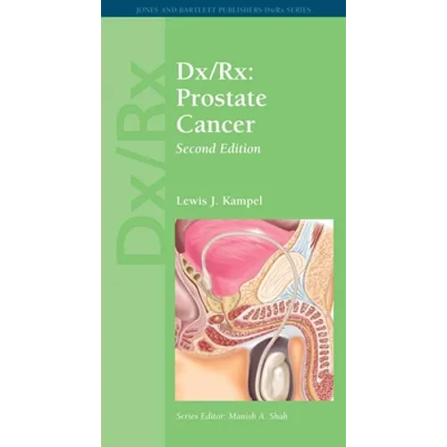 DX/Rx: Prostate Cancer: Prostate Cancer - Paperback