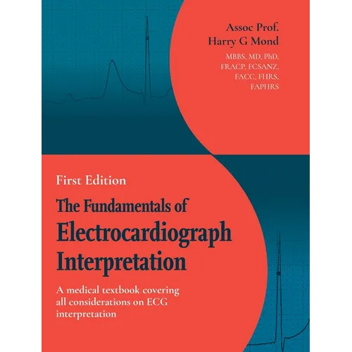 The Fundamentals of Electrocardiograph Interpretation: A medial textbook covering all considerations on ECG interpretation - Hardcover