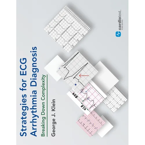 Strategies for ECG Arrhythmia Diagnosis: Breaking Down Comlexity: Breaking Down Complexity - Paperback