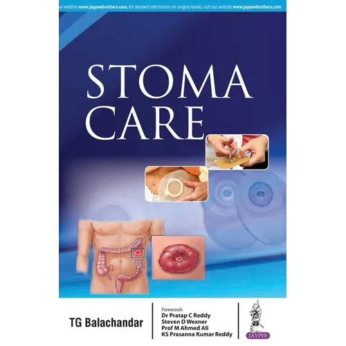 Stoma Care - Paperback