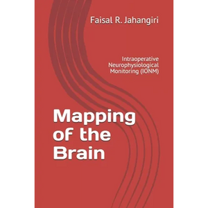 Mapping of the Brain: Intraoperative Neurophysiological Monitoring (IONM) - Paperback