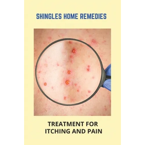 Shingles Home Remedies: Treatment For Itching And Pain: Shingles Recovery Stages - Paperback