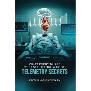 What Every Nurse Must See Before a Code: Telemetry Secrets - Paperback