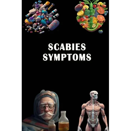 Scabies Symptoms: Recognize Scabies Symptoms - Understand Skin Infestation and Seek Treatment! - Paperback