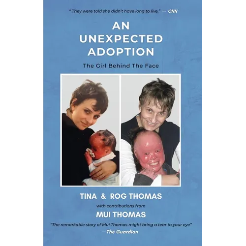 An Unexpected Adoption: The Girl Behind The Face - Paperback