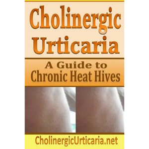 Cholinergic Urticaria: A Guide to Chronic Heat Hives - Paperback