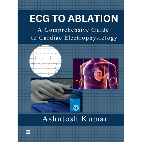 ECG to Ablation: A Comprehensive Guide to Cardiac Electrophysiology - Paperback