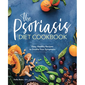 The Psoriasis Diet Cookbook: Easy, Healthy Recipes to Soothe Your Symptoms - Paperback