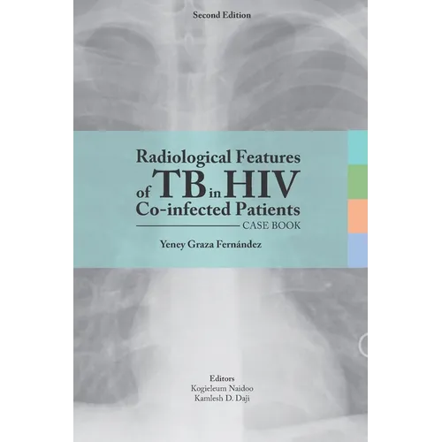 Radiological features of TB in HIV Co-infected Patients. Case book - Paperback