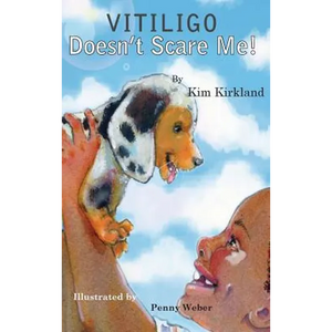 Vitiligo Doesn't Scare Me - Hardcover