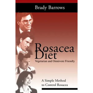 Rosacea Diet: A Simple Method to Control Rosacea - Paperback